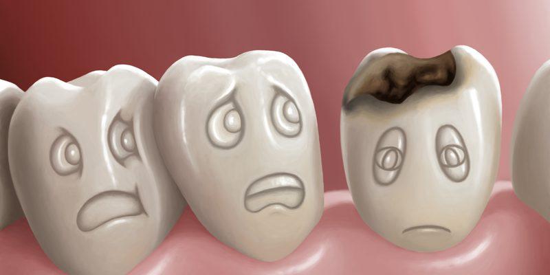 penyebab sakit gigi